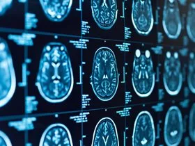 CT or MRI scan of the human brain and head